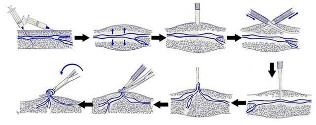 Varadi -Betrieb